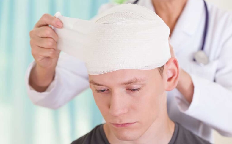 a man with head concussion