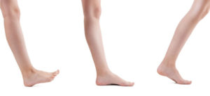 a human leg in three walking positions