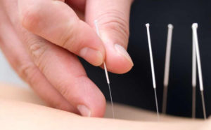acu needles in the skin