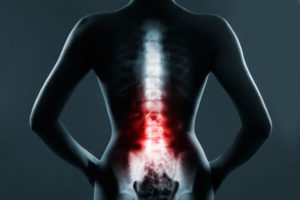 healthy spine x-ray