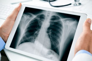 doctor holding x-ray image